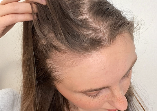 Customer hair photograph