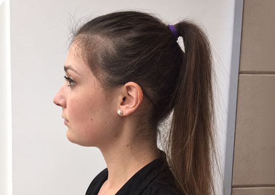 Customer hair photograph