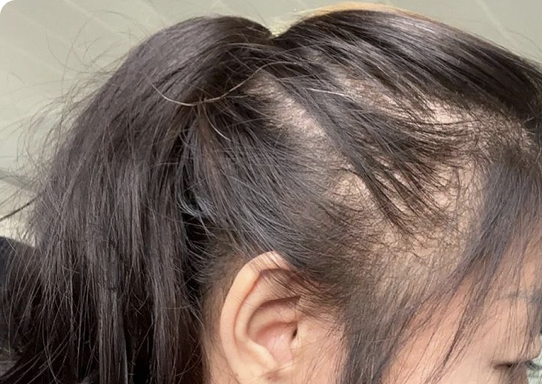 Customer hair photograph