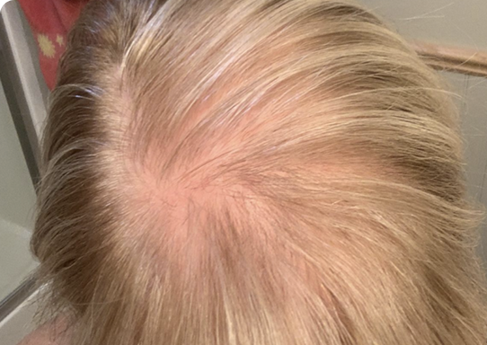 Customer hair photograph