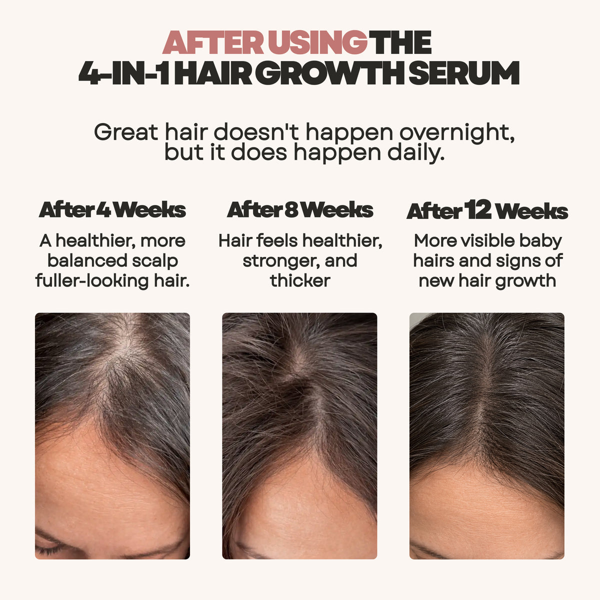 Hair Growth Serum 4-in-1