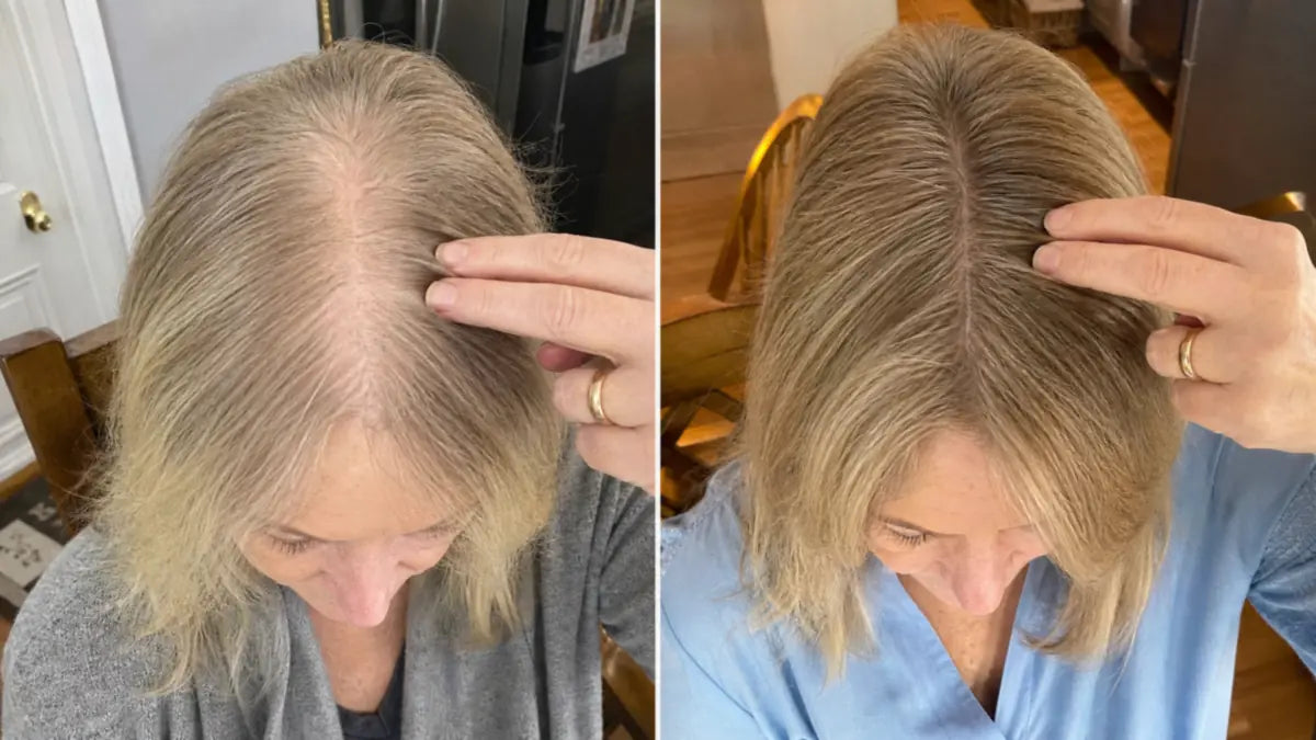 Top-down view of a woman’s wide, thinning part beside the same part filled in with thick hair