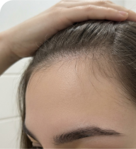 Customer hair photo