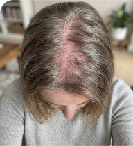 Customer hair photo