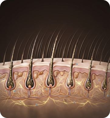 Sudden Shedding follicle illustration