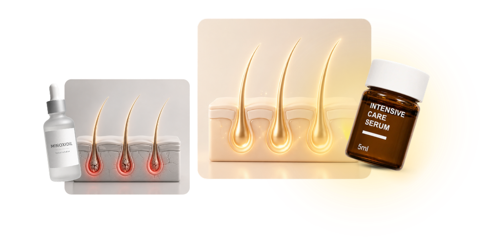 Comparison of scalp-care products and follicle illustrations